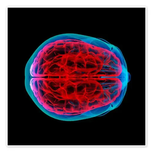 Flujo sanguíneo del cerebro Editors Choice
